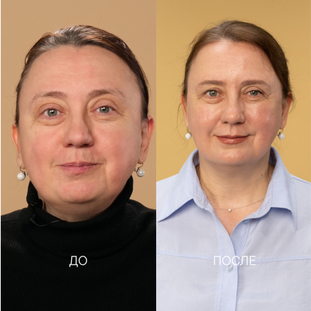 проблемы с сухостью и гиперчувствительностью кожи