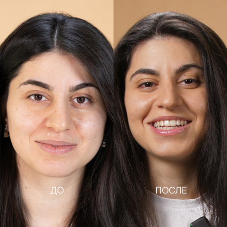 воспаления, постакне,  обезвоженность, неровный тон