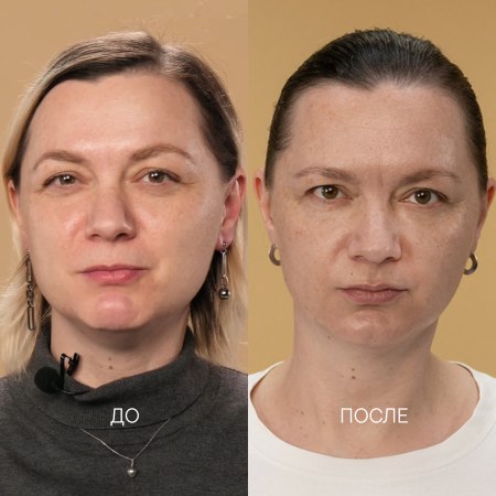 тусклый цвет лица, расширенные поры, возрастные изменения