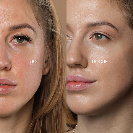 проблемы с кожей из-за неправильного домашнего ухода