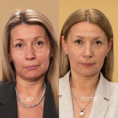 снижение эластичности повышенная чувствительность, пигментация