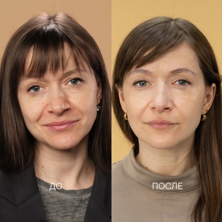 выраженные признаки обезвоженности, тусклости и значимой потери тургора кожи