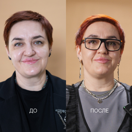 проблемы с кожей из-за неверного домашнего ухода